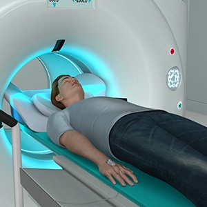 Magnetic Resonance Imaging (MRI)